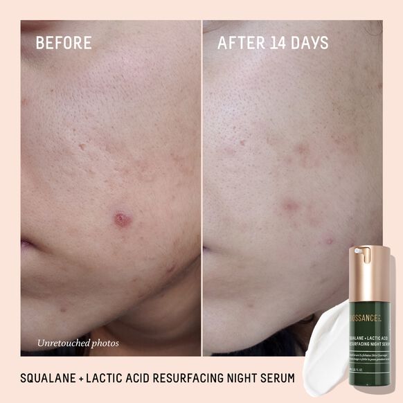 Biossance Squalane + Lactic Acid Resurfacing Night Serum